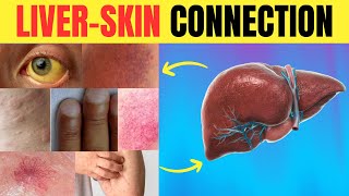 😱 Is Your Skin SCREAMING for Help 🆘 11 LIVER WARNING Signs You Might Miss  Longevity Deprocessed [upl. by Kcirrem262]