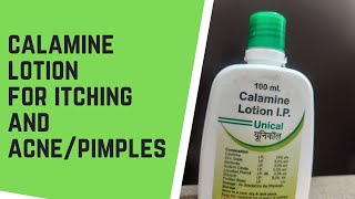 Calamine lotion for itching and acne and pimplesDermatologist skin care products116 [upl. by Adnorahc]