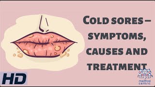 Cold Sores – Symptoms Causes and Treatment [upl. by Arehahs586]