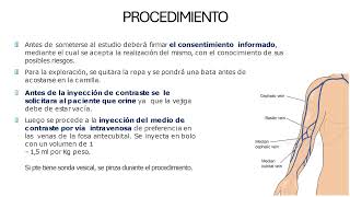 PROCEDIMIENTOS DE UROLOGIA [upl. by Estrellita839]