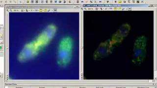 Image Deconvolution with AutoQuant Software [upl. by Attiuqram]