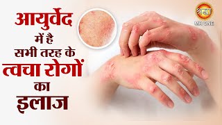 आयुर्वेद में है सभी तरह के त्वचा रोगों का इलाज  Skin disease treatment ayurveda  Ayurveda Chikitsa [upl. by Einatsed]