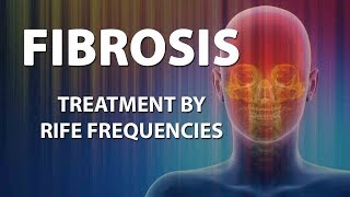 Fibrosis  RIFE Frequencies Treatment  Energy amp Quantum Medicine with Bioresonance [upl. by Ulane402]