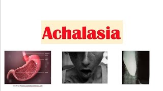 Achalasia CardiaGastroenterologyMedicineDrTayyibaarshad [upl. by Aelegna890]