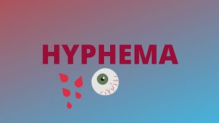 Hyphema  Definition Clinical FeaturesCauseComplicationTreatmentBlack ball 8  Ophthalmology [upl. by Huntington576]