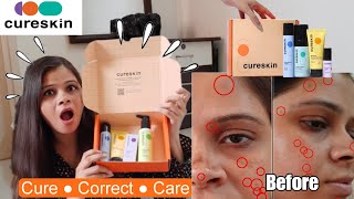 Cureskin App amp Products Review amp Everything In Between  Honest Cureskin Review  Kamna Sharma [upl. by Alinna224]