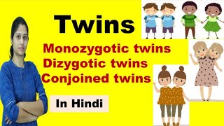 Twins  Types of Twins  Monozygotic Twins amp Dizygotic Twins  in Hindi [upl. by Nylodnew831]