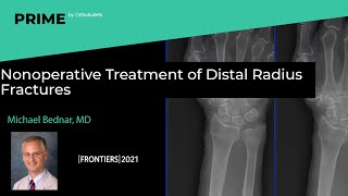 Nonoperative Treatment of Distal Radius Fractures  Michael Bednar MD [upl. by Sabelle77]