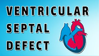 Ventricular Septal Defect [upl. by Favata346]