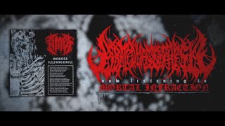 ABATED MASS OF FLESH  MORTAL INFRACTION SINGLE 2024 SW EXCLUSIVE [upl. by Eiralc915]