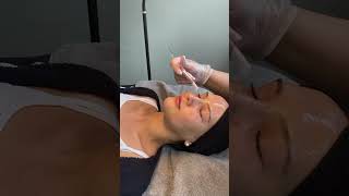 FruchtsäurepeelingMit Liebe zum Detail Kosmetiksalon Berlin ⚡️ shortsvideo skincare fruchtsäure [upl. by Sirapal]