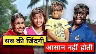 क्योंकि जीना इसी का नाम है worlds Hairiest family Gomez Family Hypertrichosis Disorder in hindi [upl. by Talanta]