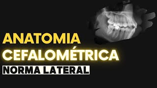 Anatomia cefalométrica Marcação de pontos craniométricos [upl. by Airdnaxela199]