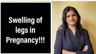 Swelling in Legs during Pregnancy  When to Worry in Kannada  Dr Sindhu Ravishankar [upl. by Yleen]