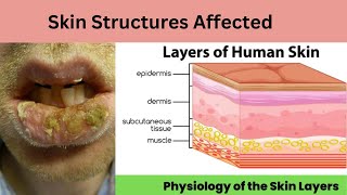 Unveiling the Pathology Skin Layers Affected by Cheilitis [upl. by Isidoro]