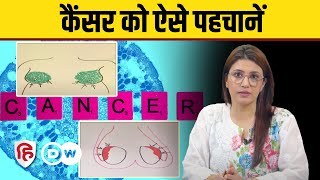 Breast Testicular amp Skin Cancer  Test at Home  कैंसर को ऐसे पहचानें  Sehat Talk [upl. by Wilde]