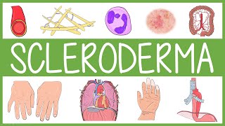 Scleroderma [upl. by Neff]