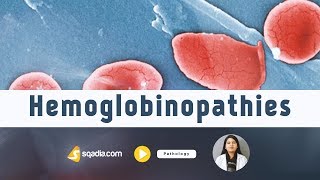 Hemoglobinopathies  Pathology Video Lectures  Medical Student Education  VLearning [upl. by Aivan30]