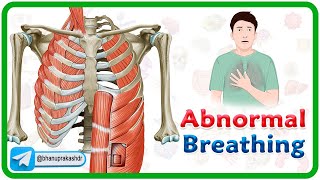 Accessory muscle Breathing Agonal Breathing Apneustic breathing Asterixis and Biots Breathing [upl. by Watson273]