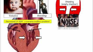 12DaysinMarch Valvular Heart Disease 8 HCM and Questions for the USMLE Step One Exam [upl. by Peppi727]