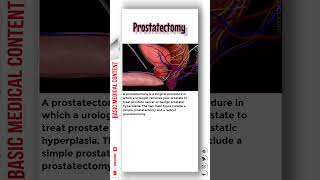 Prostatectomy prostatectomy prostatecancertreatment prostatecancerawareness [upl. by Laubin]