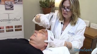 Dermaroller® Microneedling  eDermaStamp Training Video [upl. by Eelrahc]