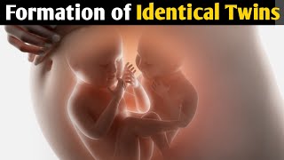 How identical twins are formed in UrduHindi  What are identical twins  Twins Facts [upl. by Rondi599]