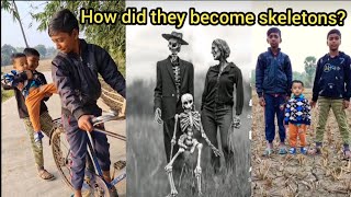 How did theyIfrazRahit and Sarfarazbecome skeletonsyoutubevideos funny [upl. by Edwine678]