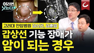 ‘갑상선 수술 후 피해야 할 음식은’ 전문의가 직접 답해드립니다ㅣ고려대안암병원 내분비내과 김신곤 유방내분비외과 김훈엽 이러면 낫는다 한국인의 5대암 특집 몰아보기ㅣ갑상선암 [upl. by Sparks]