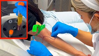 Phlebotomy Procedure for PRP  Venipuncture with Butterfly needle in 2023 [upl. by Aihsemot]