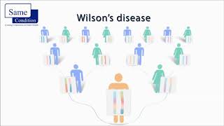 Wilsons Disease [upl. by Hcirteid996]