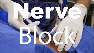 Behind The Scenes Greater Occipital Nerve Block [upl. by Jacki]