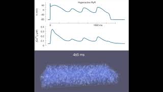 NCXmediated Subcellular Ca2 Dynamics Underlying Early Afterdepolarizations in LQT2 Cardiomyocytes [upl. by Solita]