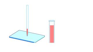 A Human Karyotype Preparation Animation [upl. by Elockin]