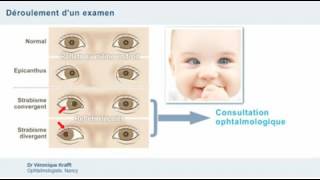 Examen ophtalmologique et dépistage des anomalies oculaires chez lenfant [upl. by Bekha59]