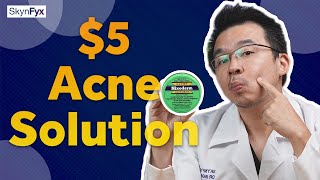 5 Acne Treatment  Cheapest Way To Get Rid Of Acne [upl. by Elleyoj]