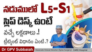 L5S1 disc prolapse symptoms diagnosis amp treatment  Health video  Dr GPV Subbaiah [upl. by Starlin676]