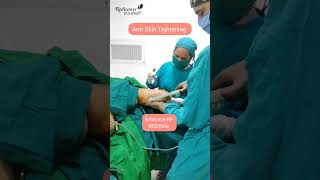 Minimally Invasive Treatment for Loose Arm Skin in Pune [upl. by Eedyah]