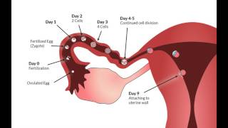 fallopian tube blockage treatment naturally [upl. by Nelson151]