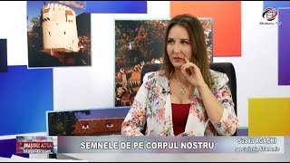 Semnele si Alunitele de pe fata  cu Suada la Brasovul Actual [upl. by Bryana]