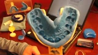 Dental Impression for Retainers Night Guard Dentures [upl. by Eatnoj]