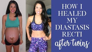 Diastasis Recti Exercises [upl. by Dalston828]