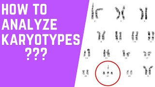 How to Analyze Karyotypes 101 [upl. by Oinimreh]