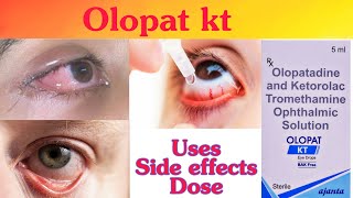 olopat kt eye drops in hindi  olopat kt drop  olopat kt eye drop uses in hindi [upl. by Whitson57]