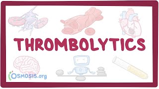 Thrombolytics pharmacology [upl. by Analli600]