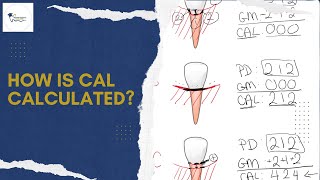 How is CAL calculated [upl. by Elockcin]