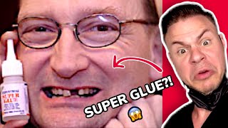 Orthodontist REACTS Fixing Broken Tooth With SUPER GLUE Shorts [upl. by Memberg]