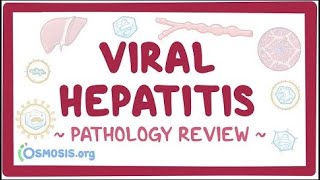 Viral hepatitis Pathology Review [upl. by Inimod]