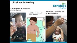 Button Gastrostomy Feeding [upl. by Adolfo476]