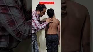 Treatment of Scoliosis scoliosis treatment spine explore trending chiropractic [upl. by Boonie476]